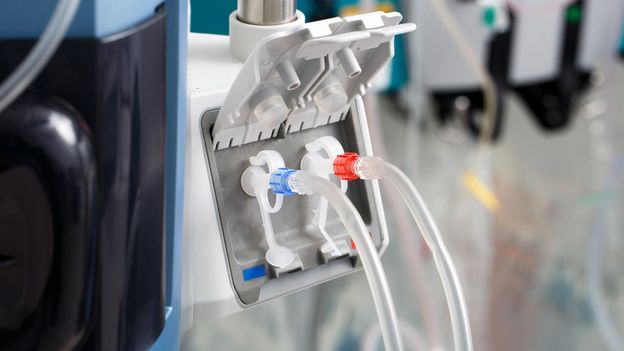 Why do more women donate organs than men?